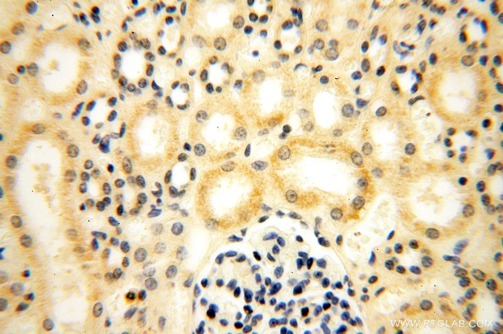 Immunohistochemistry (IHC) staining of human kidney tissue using MED28 Polyclonal antibody (16262-1-AP)