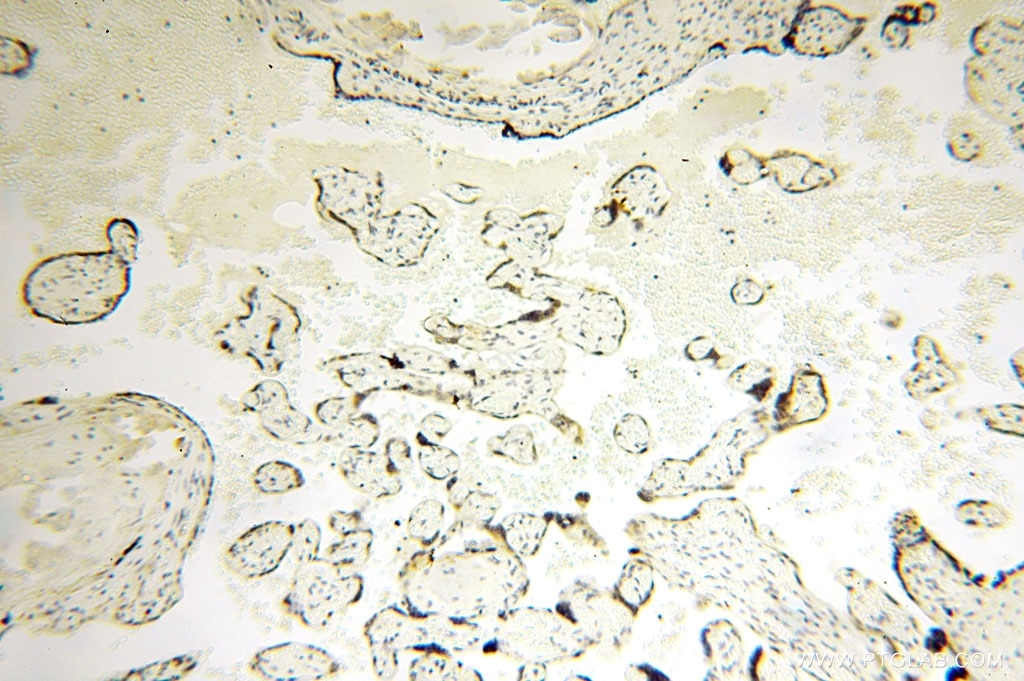 Immunohistochemistry (IHC) staining of human placenta tissue using MED28 Polyclonal antibody (16262-1-AP)
