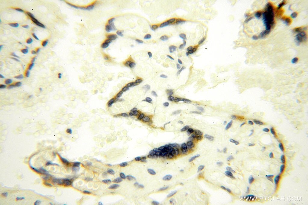 Immunohistochemistry (IHC) staining of human placenta tissue using MED28 Polyclonal antibody (16262-1-AP)