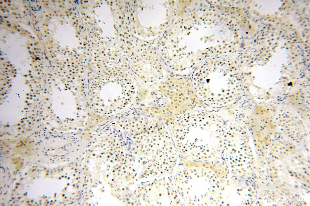 Immunohistochemistry (IHC) staining of human testis tissue using MED28 Polyclonal antibody (16262-1-AP)