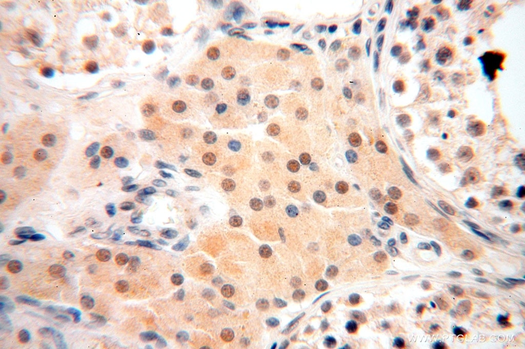 Immunohistochemistry (IHC) staining of human testis tissue using MED28 Polyclonal antibody (16262-1-AP)