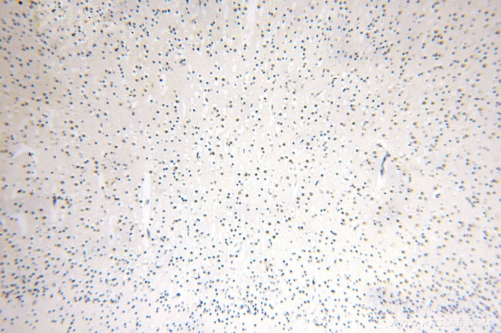 Immunohistochemistry (IHC) staining of human brain tissue using MED28 Polyclonal antibody (16262-1-AP)