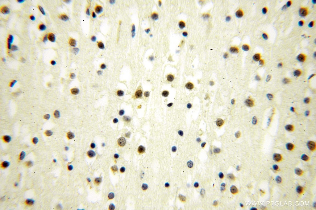 Immunohistochemistry (IHC) staining of human brain tissue using MED28 Polyclonal antibody (16262-1-AP)