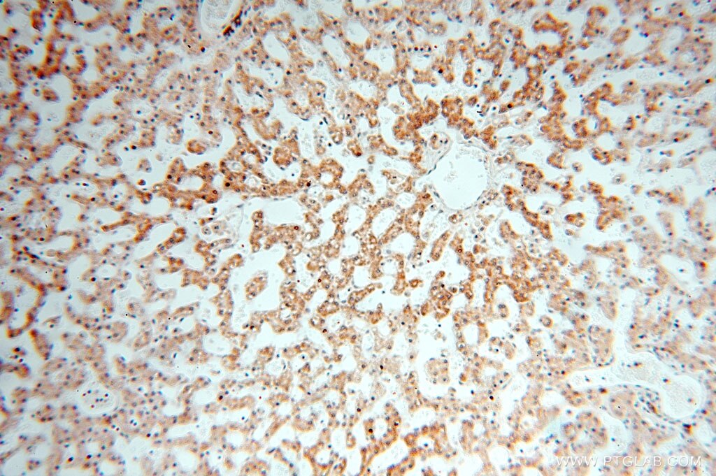 Immunohistochemistry (IHC) staining of human liver tissue using MED28 Polyclonal antibody (16262-1-AP)