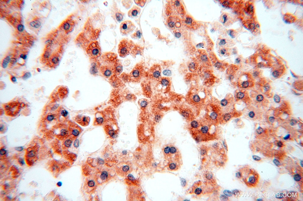 Immunohistochemistry (IHC) staining of human liver tissue using MED28 Polyclonal antibody (16262-1-AP)