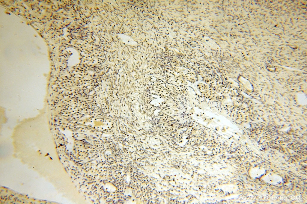 Immunohistochemistry (IHC) staining of human ovary tissue using MED28 Polyclonal antibody (16262-1-AP)