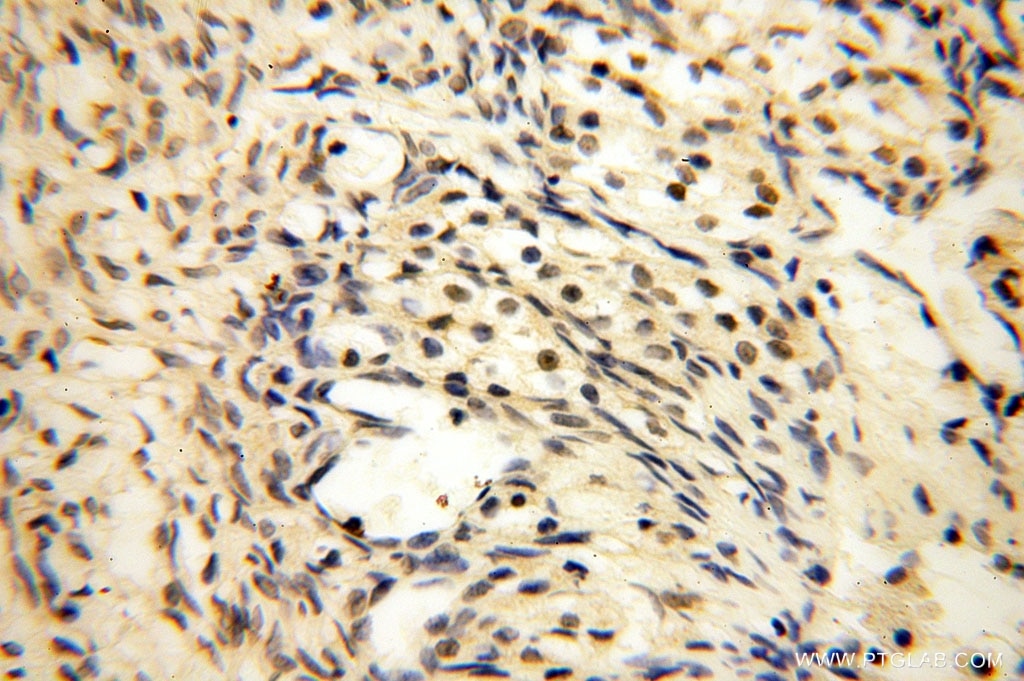 Immunohistochemistry (IHC) staining of human ovary tissue using MED28 Polyclonal antibody (16262-1-AP)