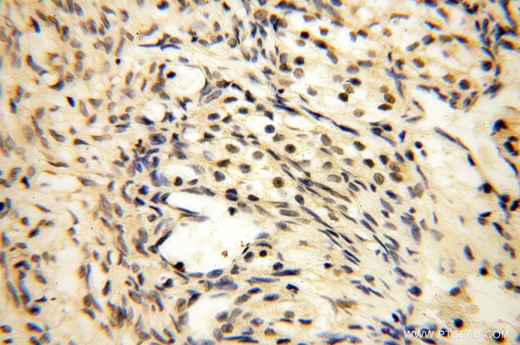 IHC staining of human ovary using 16262-1-AP