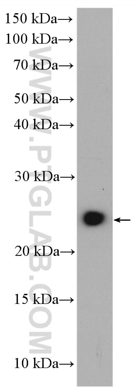 Western Blot (WB) analysis of PC-12 cells using MED28 Polyclonal antibody (16262-1-AP)