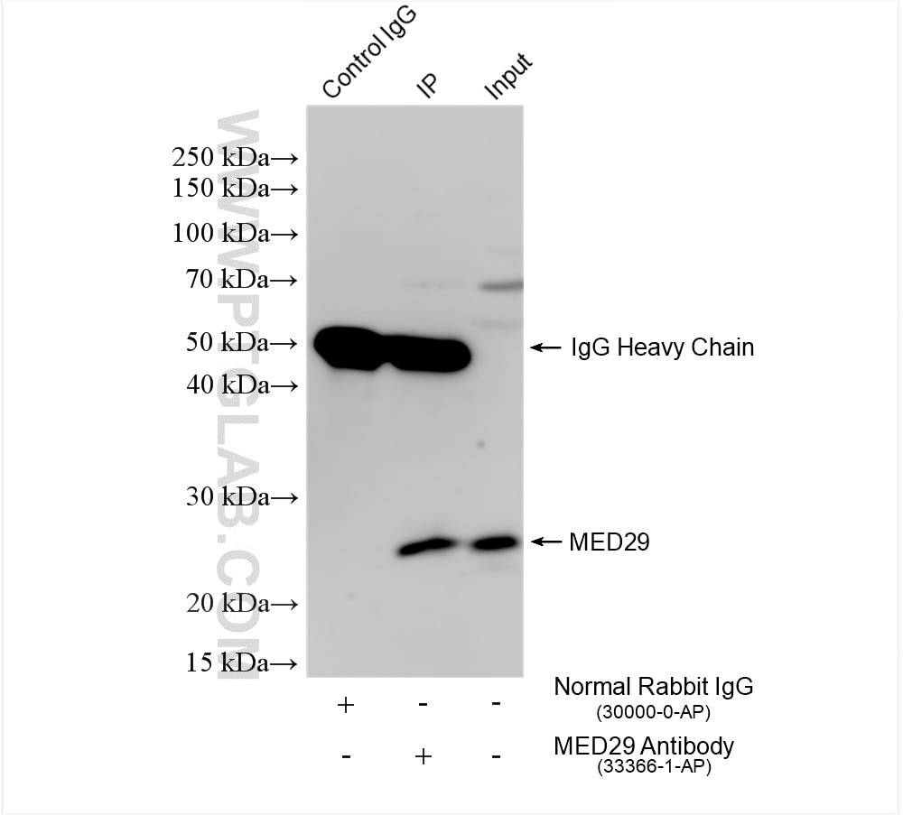 IP result of anti-MED29 (IP:33366-1-AP, 4ug; Detection:33366-1-AP 1:800) with HT-29 cells lysate 1760 ug. Immunoprecipitation (IP) experiment of HT-29 cells using MED29 Polyclonal antibody (33366-1-AP)