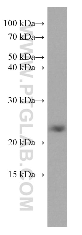 Western Blot (WB) analysis of pig brain tissue using MED30 Monoclonal antibody (67038-1-Ig)