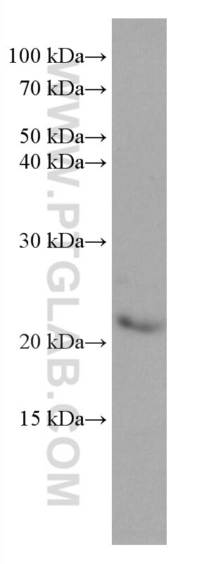 Western Blot (WB) analysis of rat brain tissue using MED30 Monoclonal antibody (67038-1-Ig)