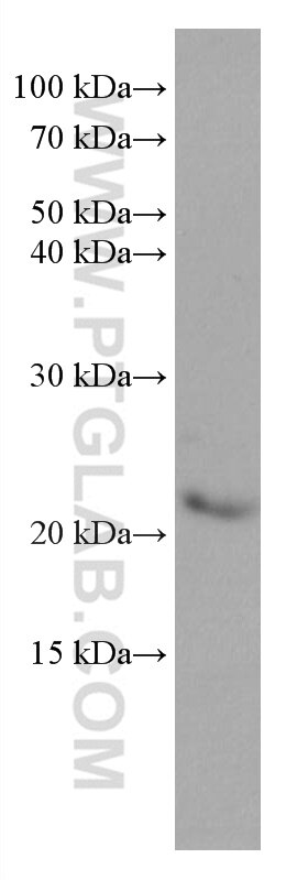 Western Blot (WB) analysis of rat brain tissue using MED30 Monoclonal antibody (67038-1-Ig)
