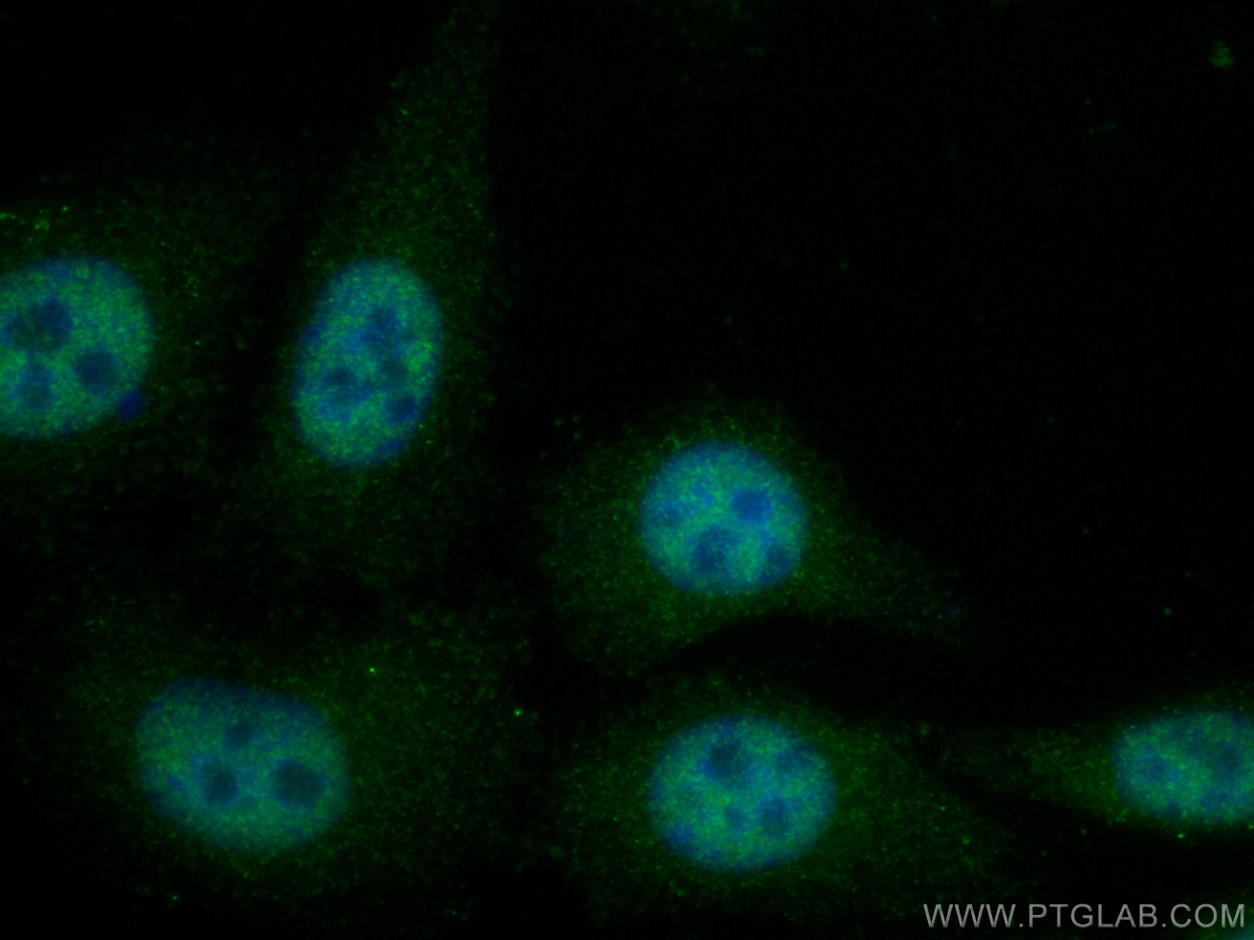 Immunofluorescence (IF) / fluorescent staining of HepG2 cells using MED31 Polyclonal antibody (16590-1-AP)