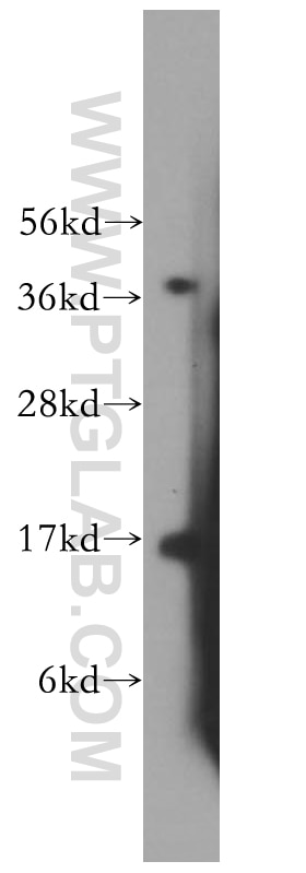 Western Blot (WB) analysis of mouse testis tissue using MED31 Polyclonal antibody (16590-1-AP)