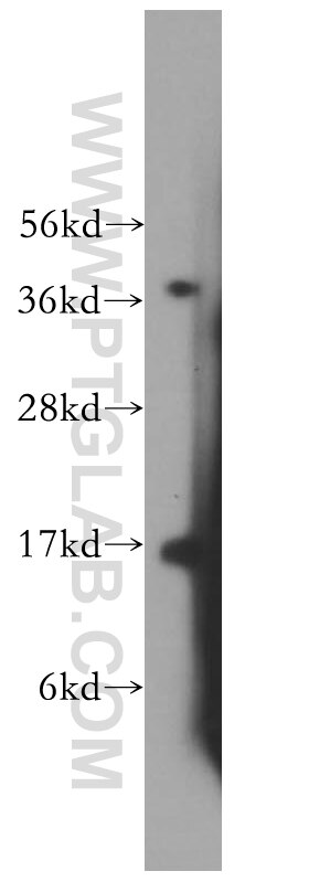 Western Blot (WB) analysis of mouse testis tissue using MED31 Polyclonal antibody (16590-1-AP)