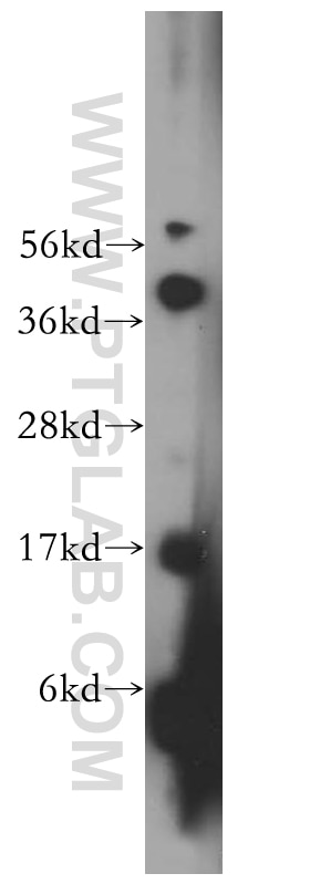 Western Blot (WB) analysis of human brain tissue using MED31 Polyclonal antibody (16590-1-AP)