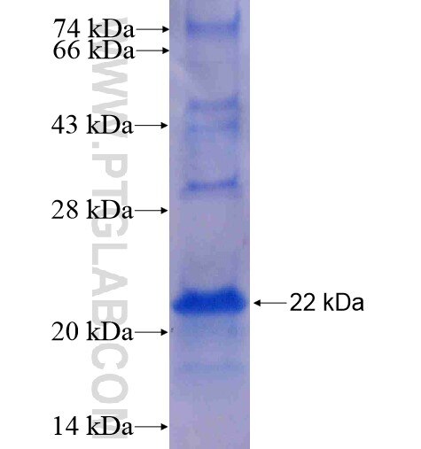 MED31 fusion protein Ag8991 SDS-PAGE