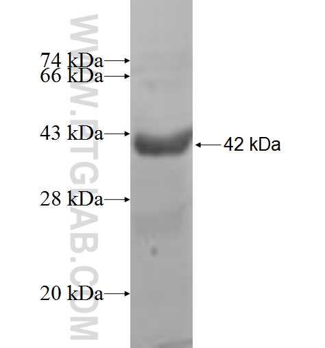 MED31 fusion protein Ag9008 SDS-PAGE