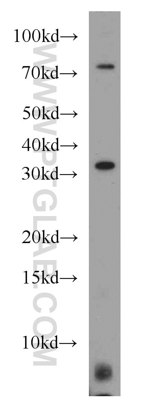 Western Blot (WB) analysis of Jurkat cells using MED4 Polyclonal antibody (15951-1-AP)