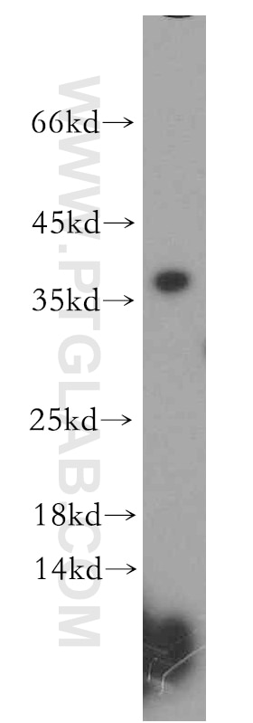 Western Blot (WB) analysis of Jurkat cells using MED4 Polyclonal antibody (15951-1-AP)