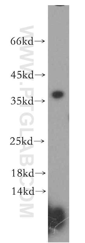 WB analysis of Jurkat using 15951-1-AP