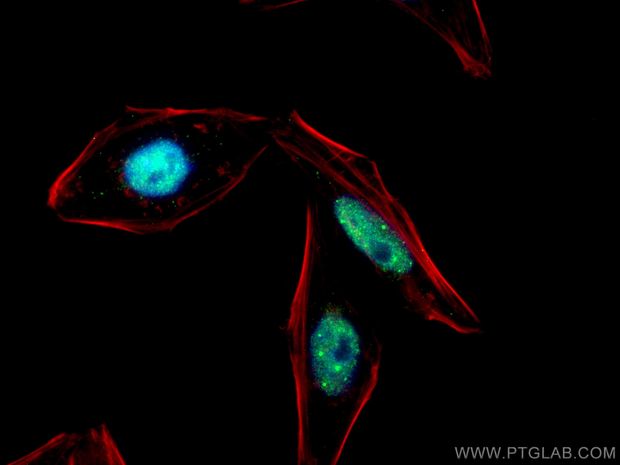 Immunofluorescence (IF) / fluorescent staining of HepG2 cells using MED4 Monoclonal antibody (67839-1-Ig)