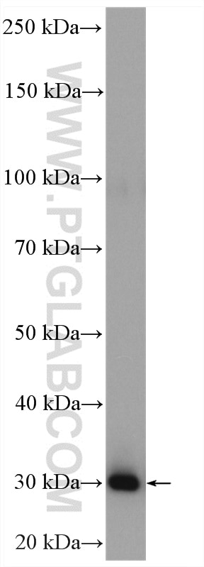 Western Blot (WB) analysis of Jurkat cells using MED6 Polyclonal antibody (15338-1-PBS)