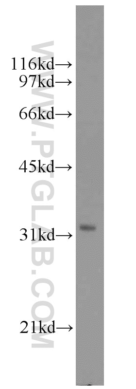 Western Blot (WB) analysis of A431 cells using MED6 Polyclonal antibody (15338-1-AP)