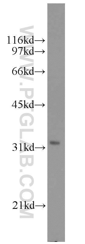 WB analysis of A431 using 15338-1-AP