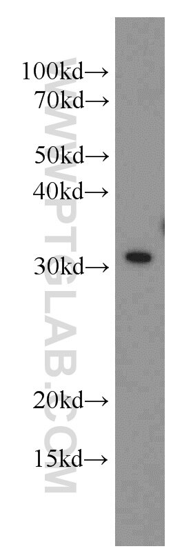MED6 Polyclonal antibody