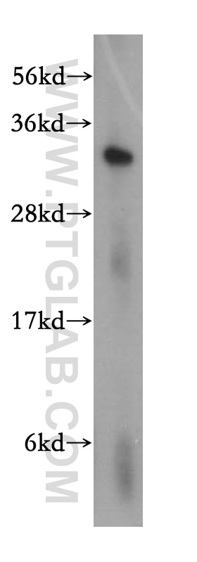 Western Blot (WB) analysis of Jurkat cells using MED6 Polyclonal antibody (15338-1-AP)