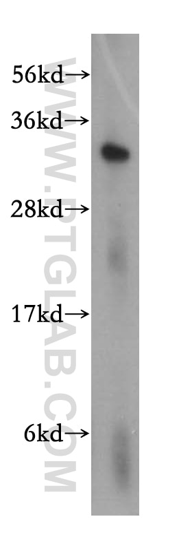 WB analysis of Jurkat using 15338-1-AP