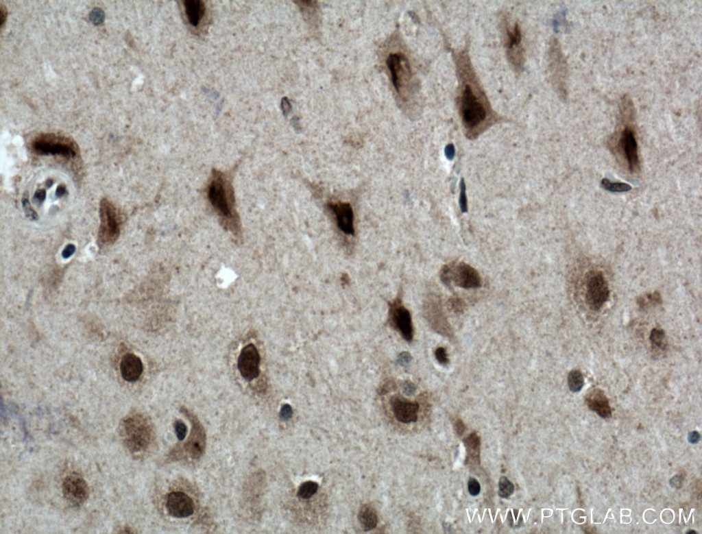 Immunohistochemistry (IHC) staining of human brain tissue using MED8 Polyclonal antibody (12182-1-AP)