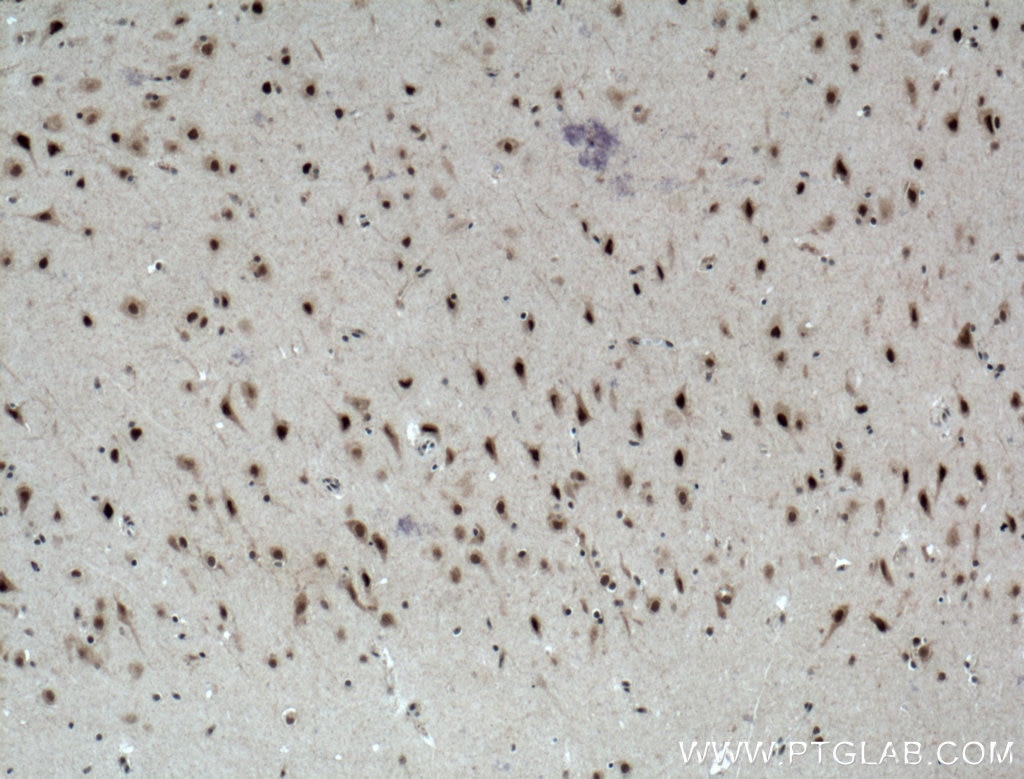 Immunohistochemistry (IHC) staining of human brain tissue using MED8 Polyclonal antibody (12182-1-AP)