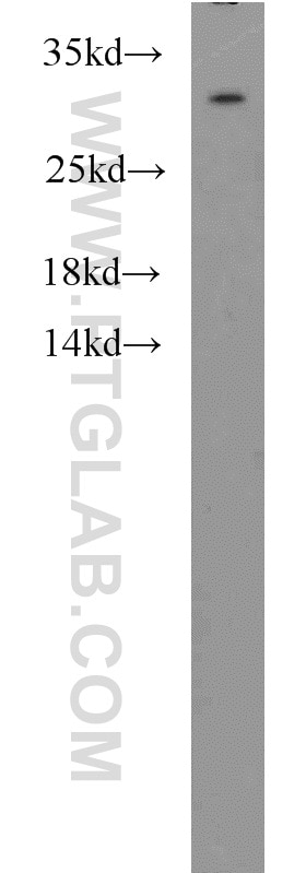 Western Blot (WB) analysis of HepG2 cells using MED8 Polyclonal antibody (12182-1-AP)