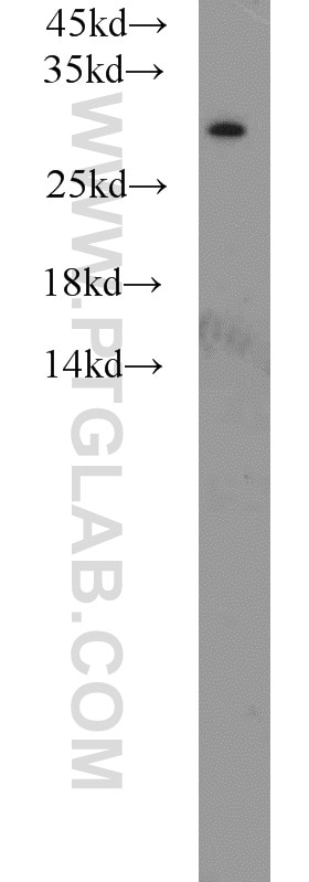 Western Blot (WB) analysis of mouse liver tissue using MED8 Polyclonal antibody (12182-1-AP)