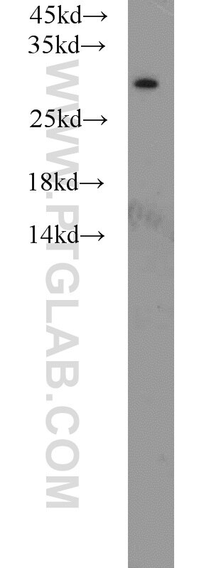 Western Blot (WB) analysis of mouse liver tissue using MED8 Polyclonal antibody (12182-1-AP)