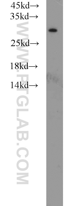 Western Blot (WB) analysis of mouse liver tissue using MED8 Polyclonal antibody (12182-1-AP)