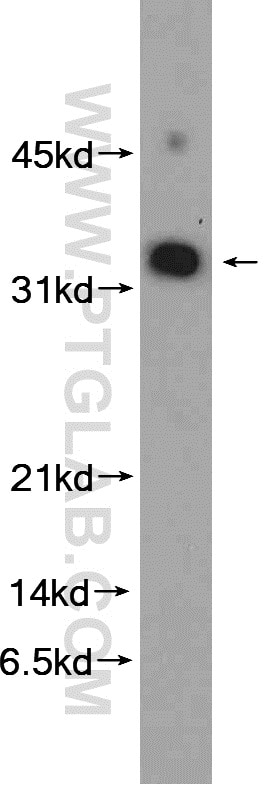 Western Blot (WB) analysis of SGC-7901 cells using MED8 Polyclonal antibody (12182-1-AP)