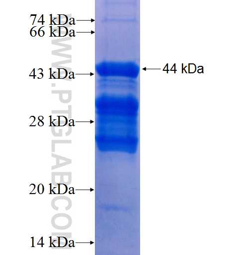 MED9 fusion protein Ag26158 SDS-PAGE