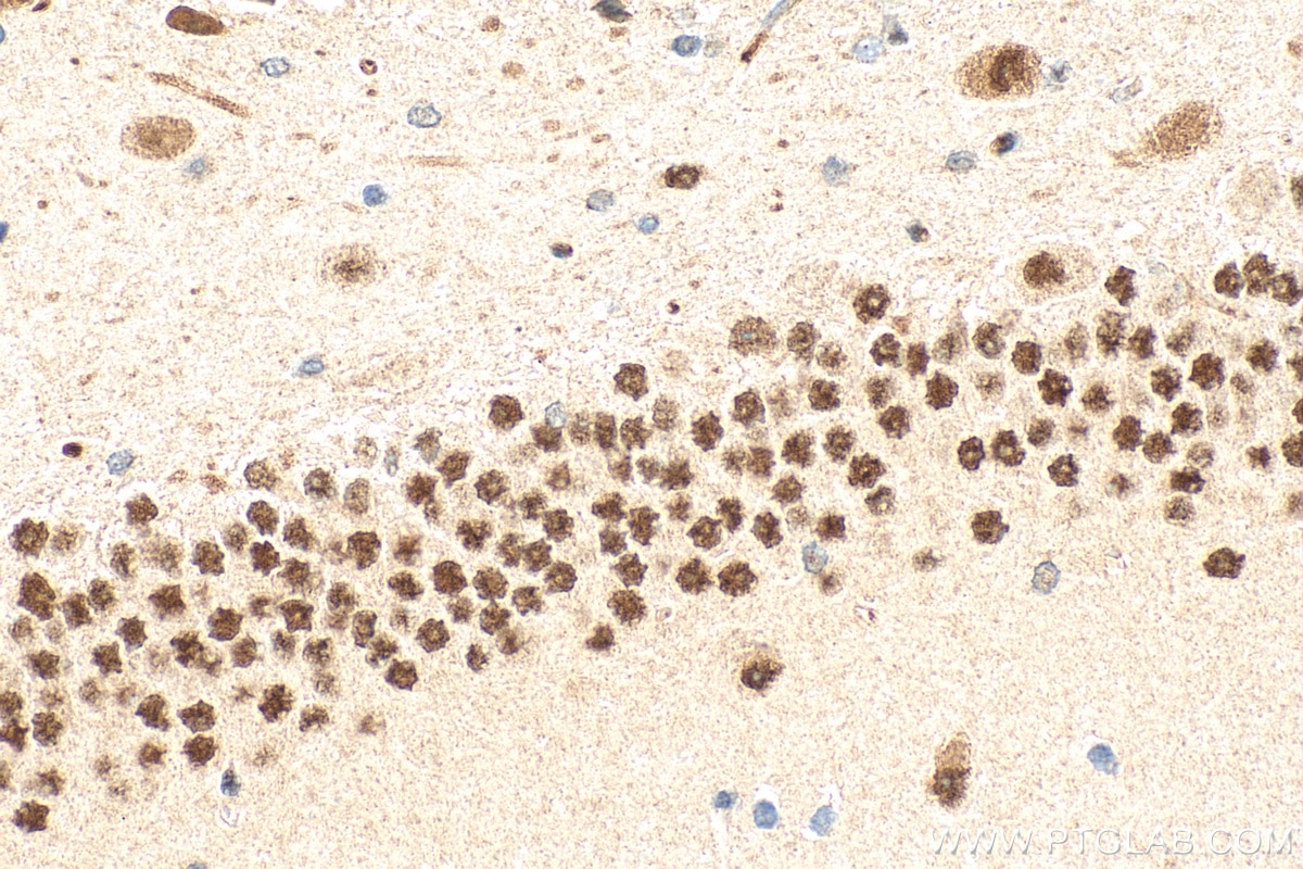 Immunohistochemical analysis of paraffin-embedded rat brain tissue slide using 12382-1-AP (MEF2A antibody) at dilution of 1:200 (under 10x lens). Heat mediated antigen retrieval with Tris-EDTA buffer (pH 9.0). Immunohistochemistry (IHC) staining of rat brain tissue using MEF2A Polyclonal antibody (12382-1-AP)
