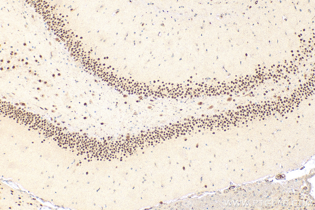Immunohistochemical analysis of paraffin-embedded rat brain tissue slide using 12382-1-AP (MEF2A antibody) at dilution of 1:200 (under 40x lens). Heat mediated antigen retrieval with Tris-EDTA buffer (pH 9.0). Immunohistochemistry (IHC) staining of rat brain tissue using MEF2A Polyclonal antibody (12382-1-AP)