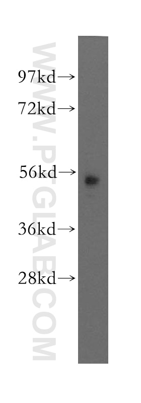 Western Blot (WB) analysis of mouse pancreas tissue using MEF2A Polyclonal antibody (12382-1-AP)