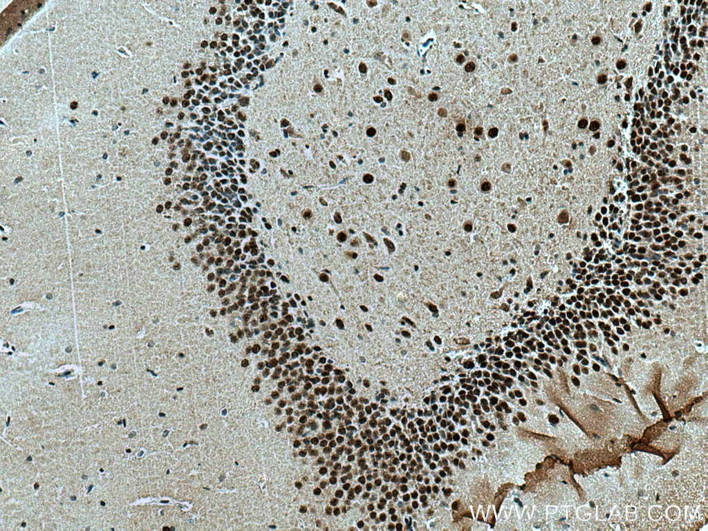 Immunohistochemistry (IHC) staining of rat brain tissue using MEF2A Polyclonal antibody (28819-1-AP)