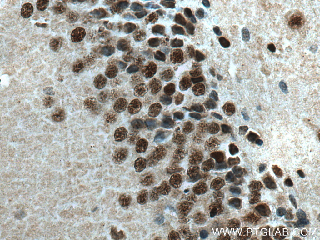 Immunohistochemistry (IHC) staining of rat brain tissue using MEF2A Polyclonal antibody (28819-1-AP)