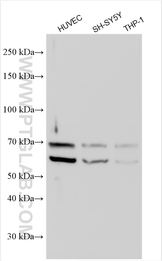 Western Blot (WB) analysis of various lysates using MEF2A Polyclonal antibody (28819-1-AP)