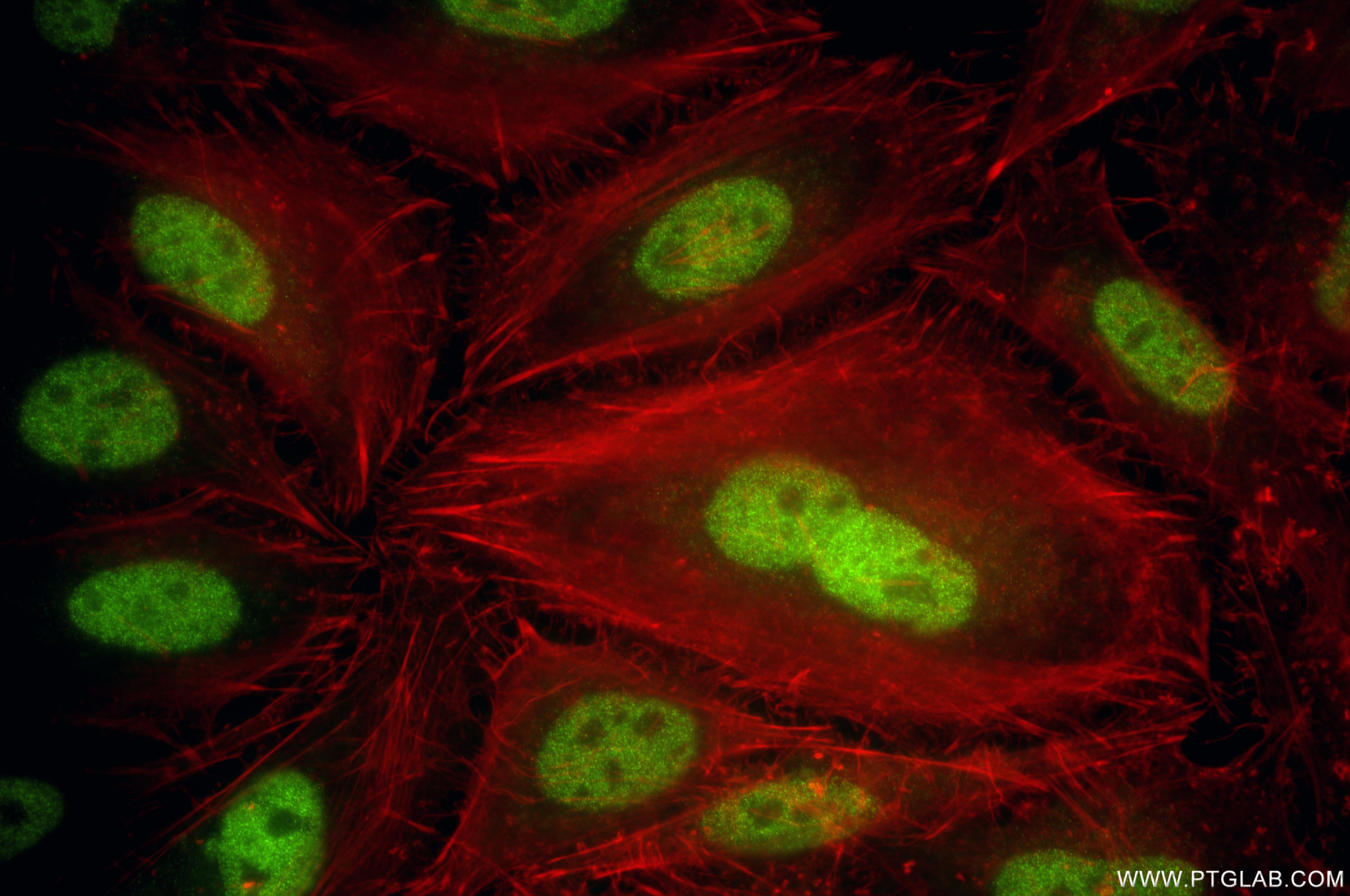 Immunofluorescence (IF) / fluorescent staining of HeLa cells using MEF2A Recombinant monoclonal antibody (87660-2-RR)