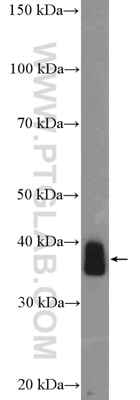 Western Blot (WB) analysis of mouse skeletal muscle tissue using MEF2B (isoform 365aa)-Specific Polyclonal antibody (18710-1-AP)