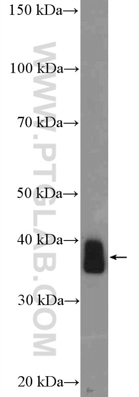 WB analysis of mouse skeletal muscle using 18710-1-AP